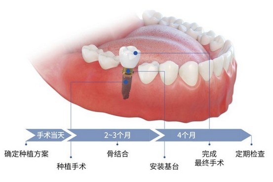 深圳羅湖春風口腔醫院